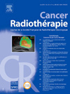 Cancer Radiotherapie